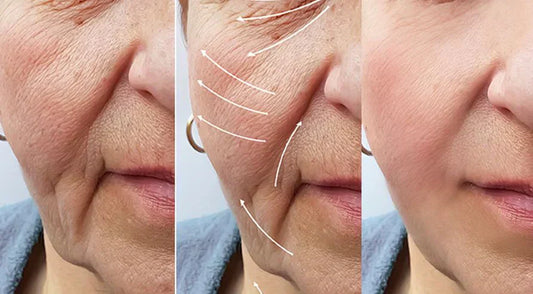 Erase Wrinkles Naturally with Red Light